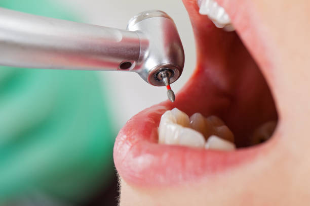 Best Emergency Denture Repair in Medina, NY